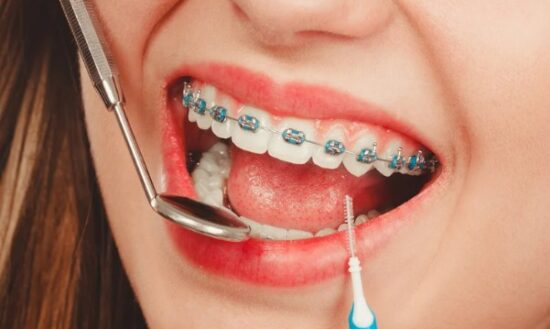 Oral Health and Bite Examination