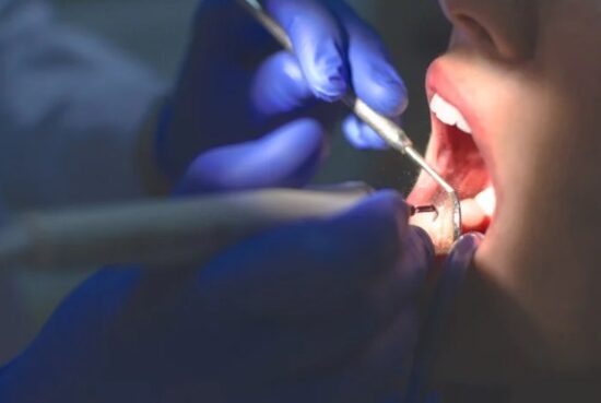 The Rising Demand for Advanced Dental Restoration