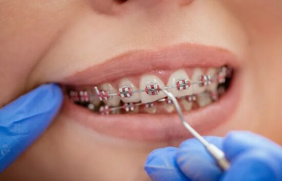 Treatment Plan and Braces Options