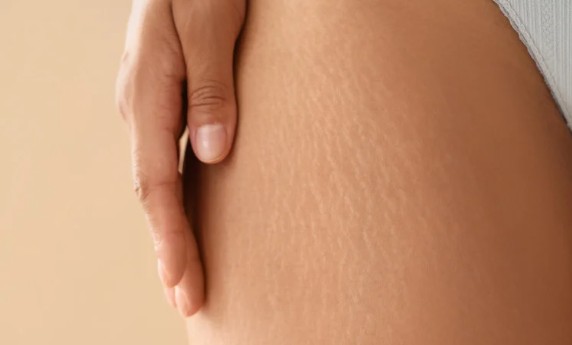 Why Some Skin Marks Fade, and Others Need Guidance