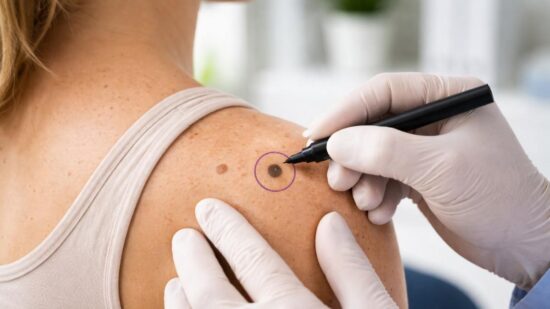 What to Expect During a Skin Check